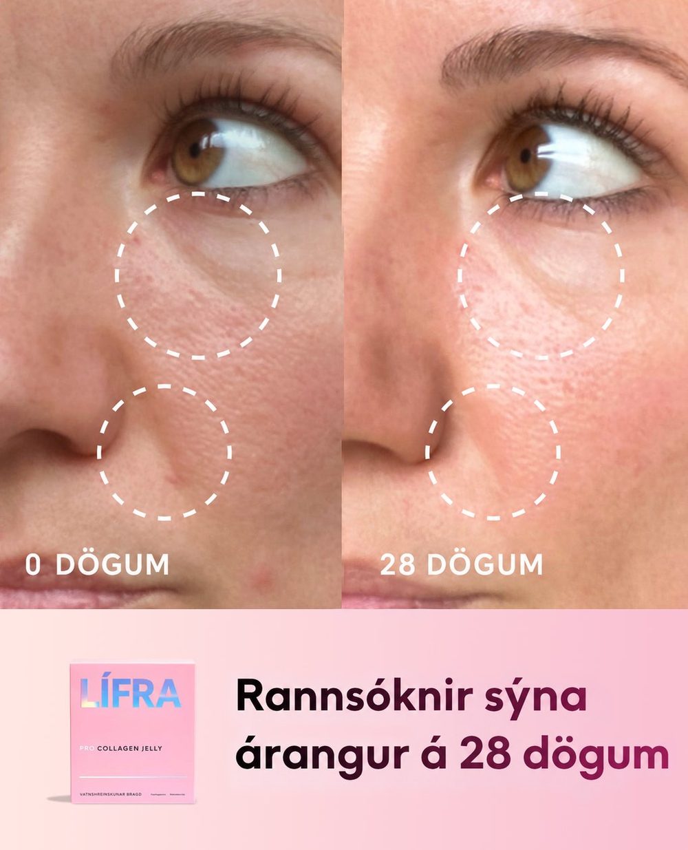 LÍFRA Pro Kollagenhlaup